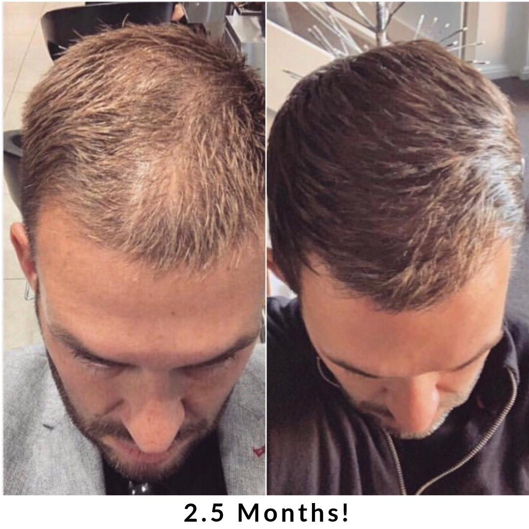 Hair + Energy Formula