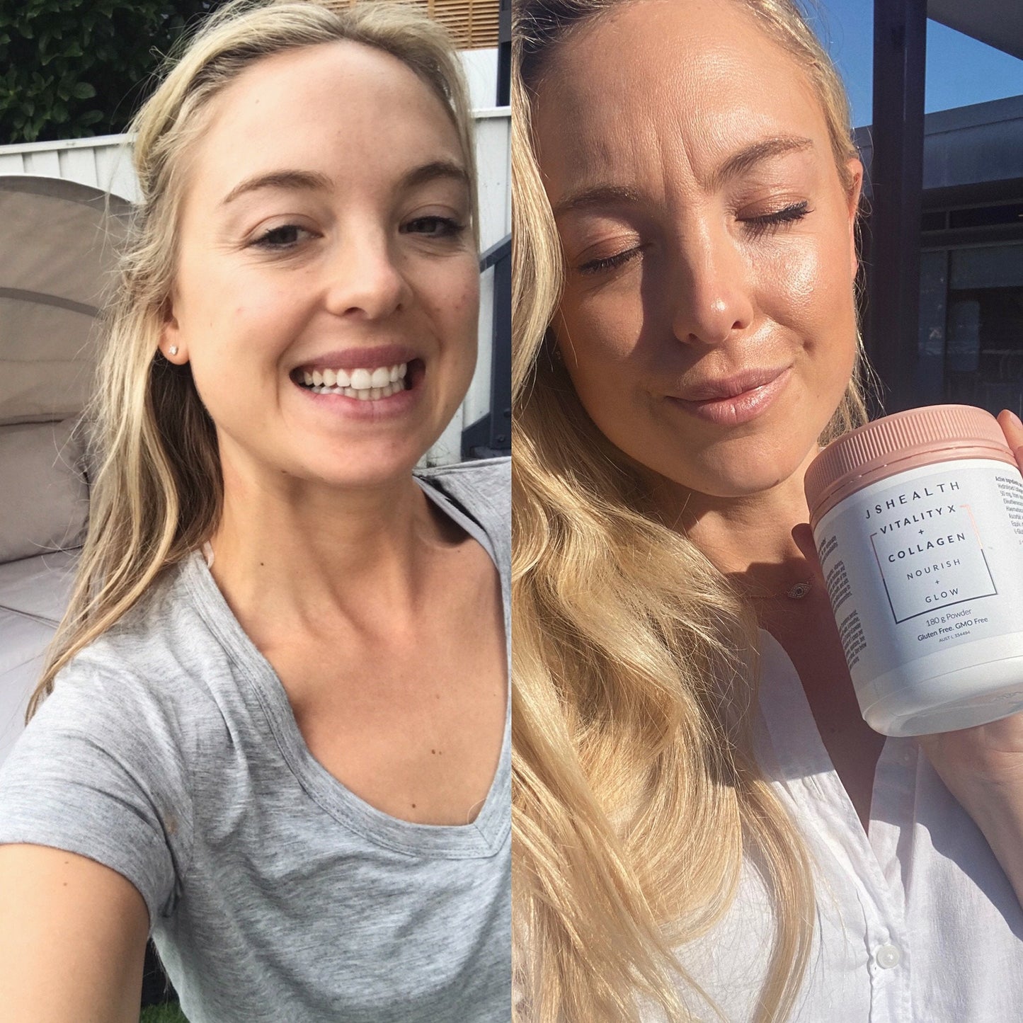 Beauty Boost Kit - SIX MONTH SUPPLY