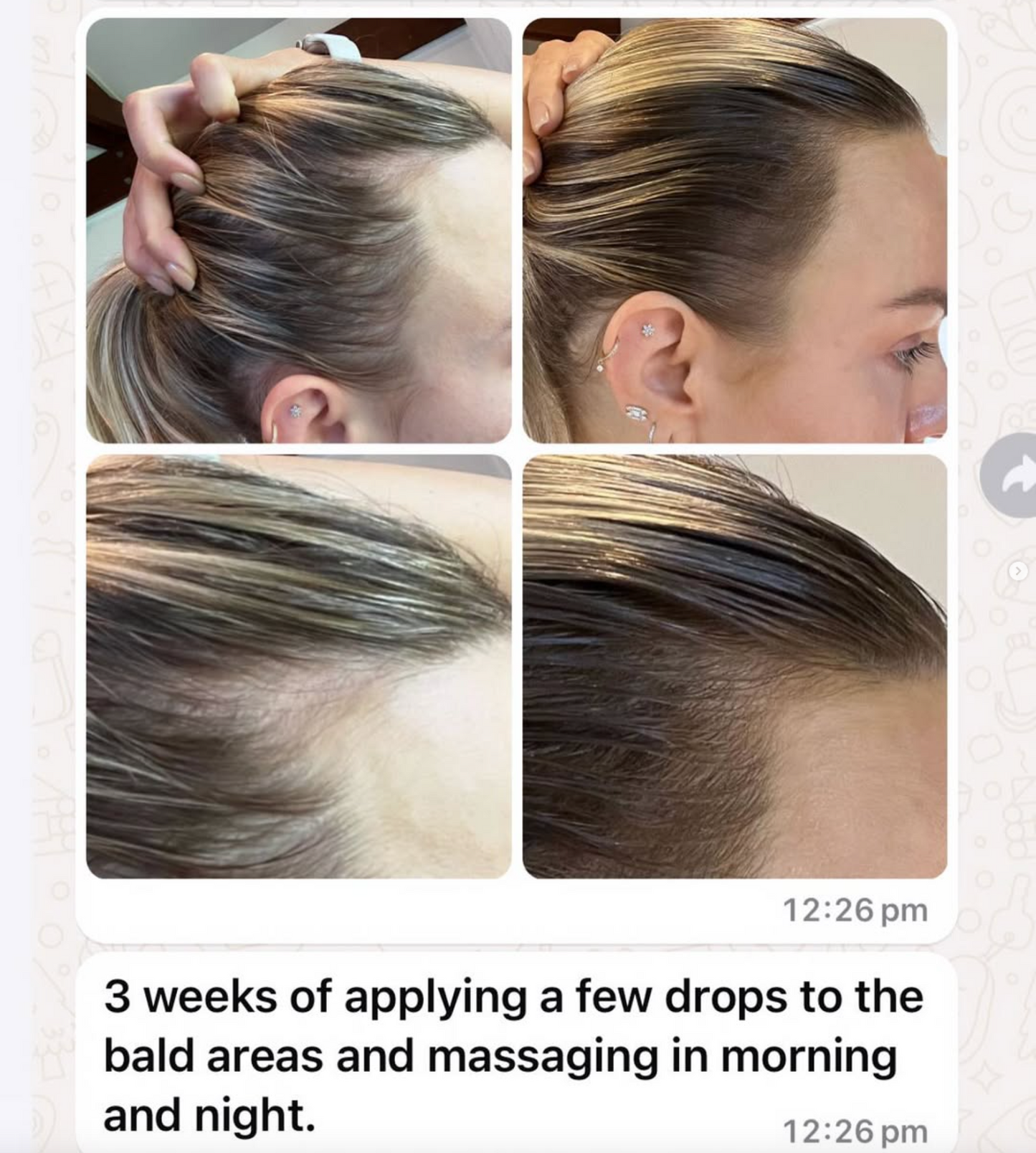 Vita-Growth Scalp Serum