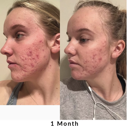 Skin + Digestion Formula
