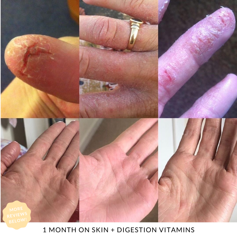 Skin + Digestion Twin Pack - 6 MONTH SUPPLY