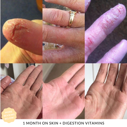 Skin + Digestion Twin Pack - 6 MONTH SUPPLY