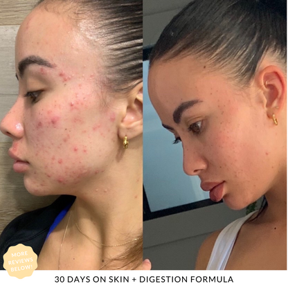 Skin + Digestion Twin Pack - 6 MONTH SUPPLY
