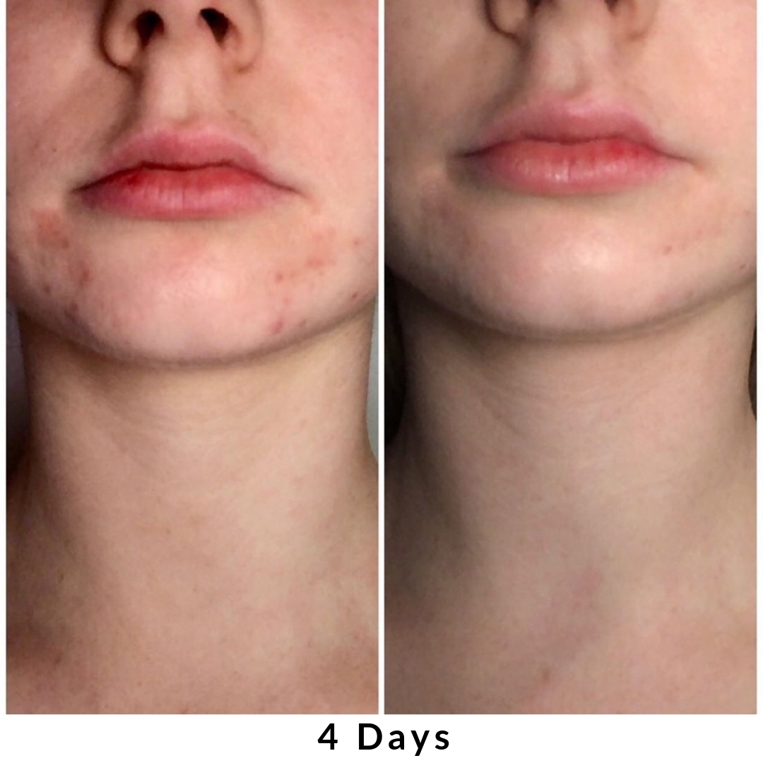 Skin + Digestion Formula