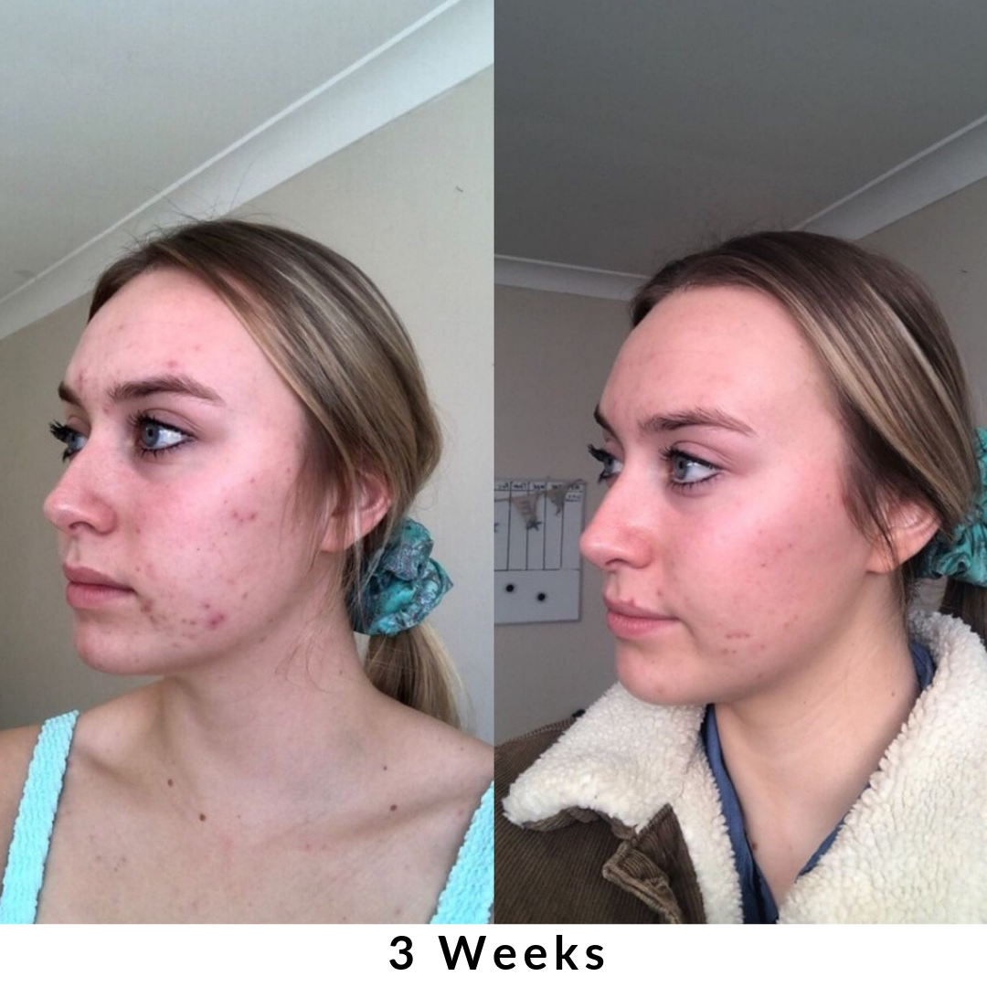 Skin + Digestion Formula