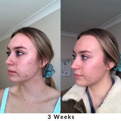 Skin + Digestion Formula