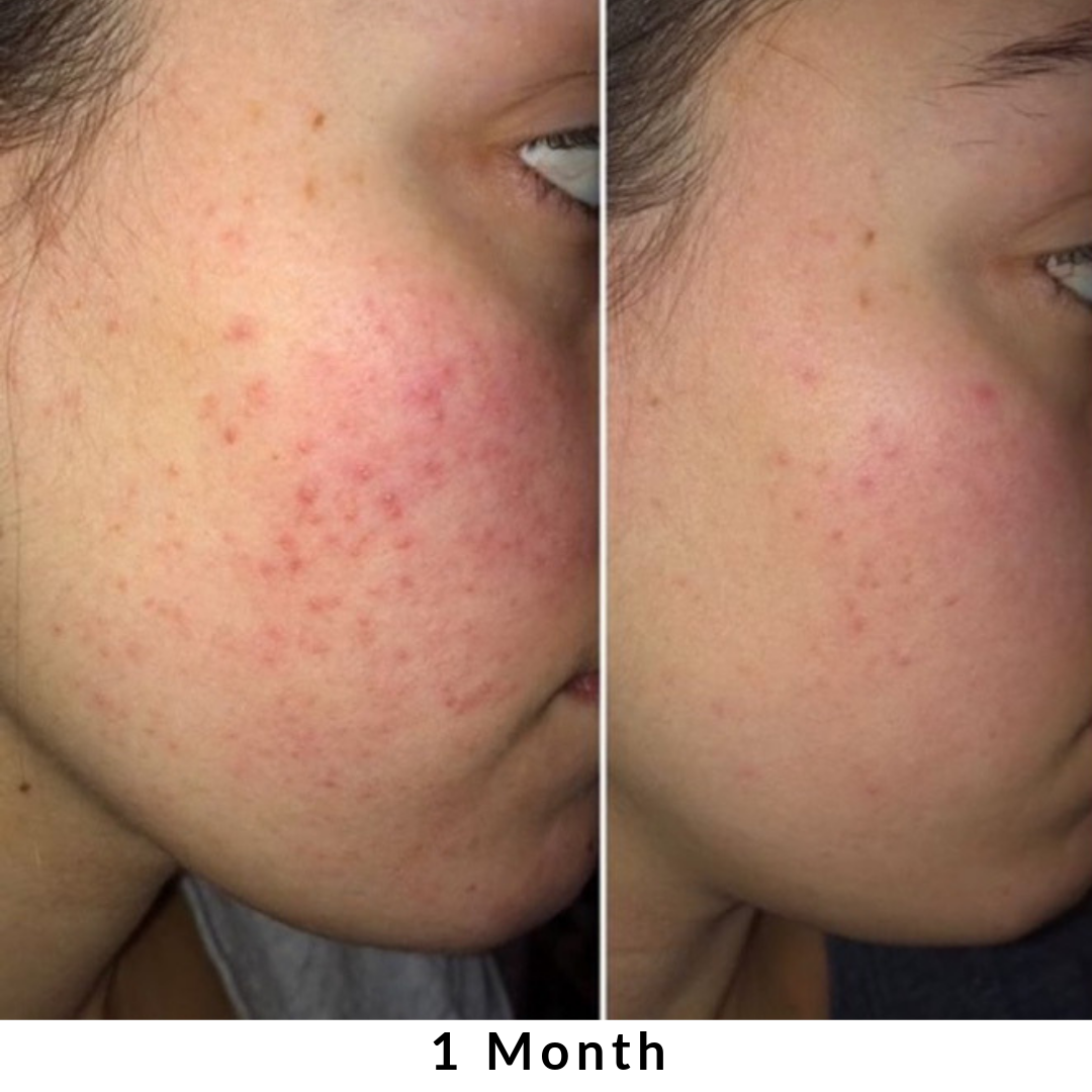 Skin + Digestion Formula