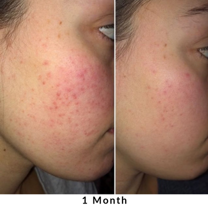 Skin + Digestion Formula