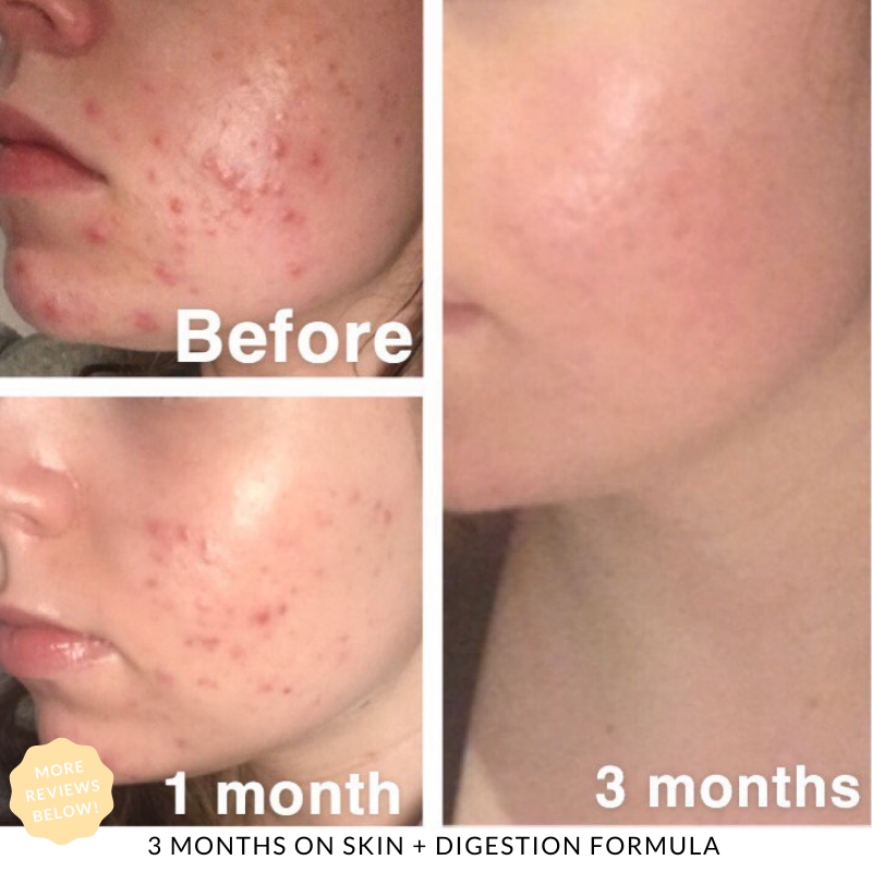 Skin + Digestion Twin Pack - 6 MONTH SUPPLY