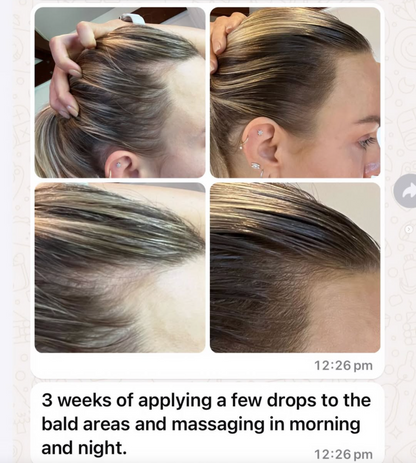 Vita-Growth Scalp Serum